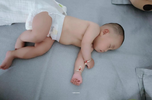 阿里宝宝头上长痱子